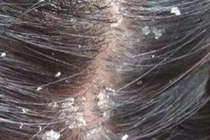 犬马拉色菌（揭秘犬马拉色菌的生物特性、致病机制及防控策略）