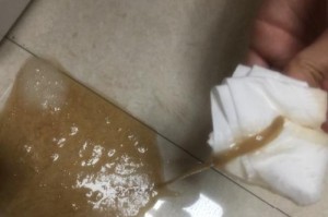 小狗得了细小，为何老卡？（探究细小病毒对小狗身体的影响和老卡现象的原因）