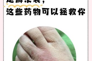 土狗皮肤病治疗药物及建议（全面了解土狗皮肤病，掌握正确用药方法）