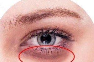眼睛凸起的原因及相关疾病分析（眼球突出、眼睛突出的原因及治疗方法）