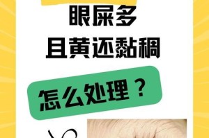 如何有效处理眼角屎黄问题（选择适合的药物是关键）
