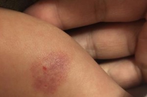 生宝宝前的常见症状及应对方法（了解这些症状，为宝宝的健康做好准备）