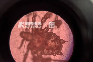 弓形虫卵的存活能力及影响因素分析（弓形虫卵存活时间及关键影响因素解析）