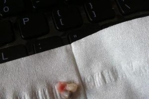 狗狗掉牙后的饮食护理（营养均衡是关键，关爱狗狗牙齿健康）