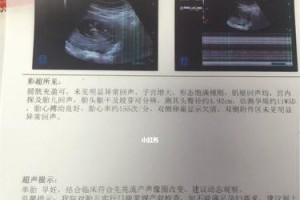 狗狗流产后需要多久才能完全排出胎盘？（了解狗狗流产后胎盘排出的时间和注意事项）