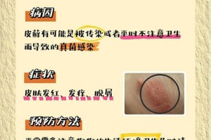 犬瘟热的治疗方法及预防措施（了解犬瘟热的传染途径和症状，有效防治关键）
