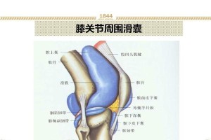 膝关节囊肿（膝关节囊肿的康复周期和关键护理方法）