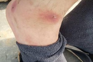 以脚冷就经常咬痛的原因究竟是什么？（寻找解决脚部冷痛的方法）