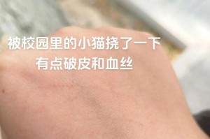 猫为什么总是要挠人？（探究猫咪挠人的原因和行为背后的意义）