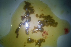泰迪狗的大便和身体健康（一起了解泰迪狗的排便状况和健康指标）