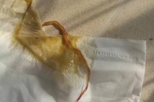 小狗吐透明液体，可能存在的健康问题（了解小狗吐透明液体的原因及应对方法）