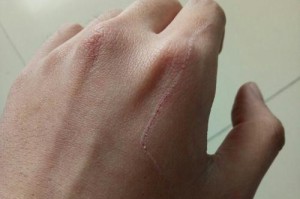 狗狗爪子抓伤的处理与预防（宠物狗狗爪子抓伤的原因、急救方法及预防措施）