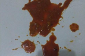 狗狗肠道出血的治疗与饮食指南（了解狗狗肠道出血症状与预防，科学调配饮食是关键）