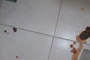狗拉血的症状及处理方法（详解狗拉血的症状、原因和治疗方法）