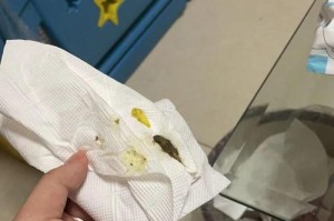 狗狗大便里的虫子究竟是什么颜色的？（揭秘狗狗肠道寄生虫的颜色特征及相关问题）