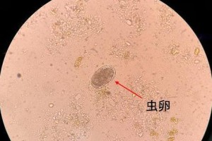 犬粪便中的虫卵及其危害（犬粪便中常见的虫卵有哪些？如何防范犬粪带来的健康风险？）