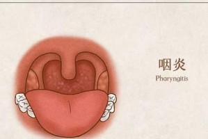 探究咳嗽的原因及解决方法（揭开常见咳嗽的真相，告别困扰！）