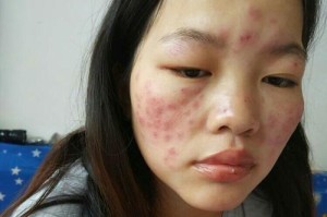 深入了解法斗水肿的原因（揭开法斗水肿背后的真相，警惕这些潜在危险）
