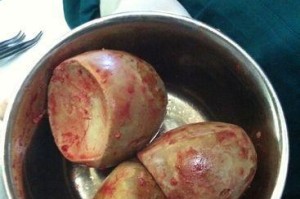 膀胱结石手术选择及其关键因素（探讨膀胱结石手术方法的选择以及关键因素分析）